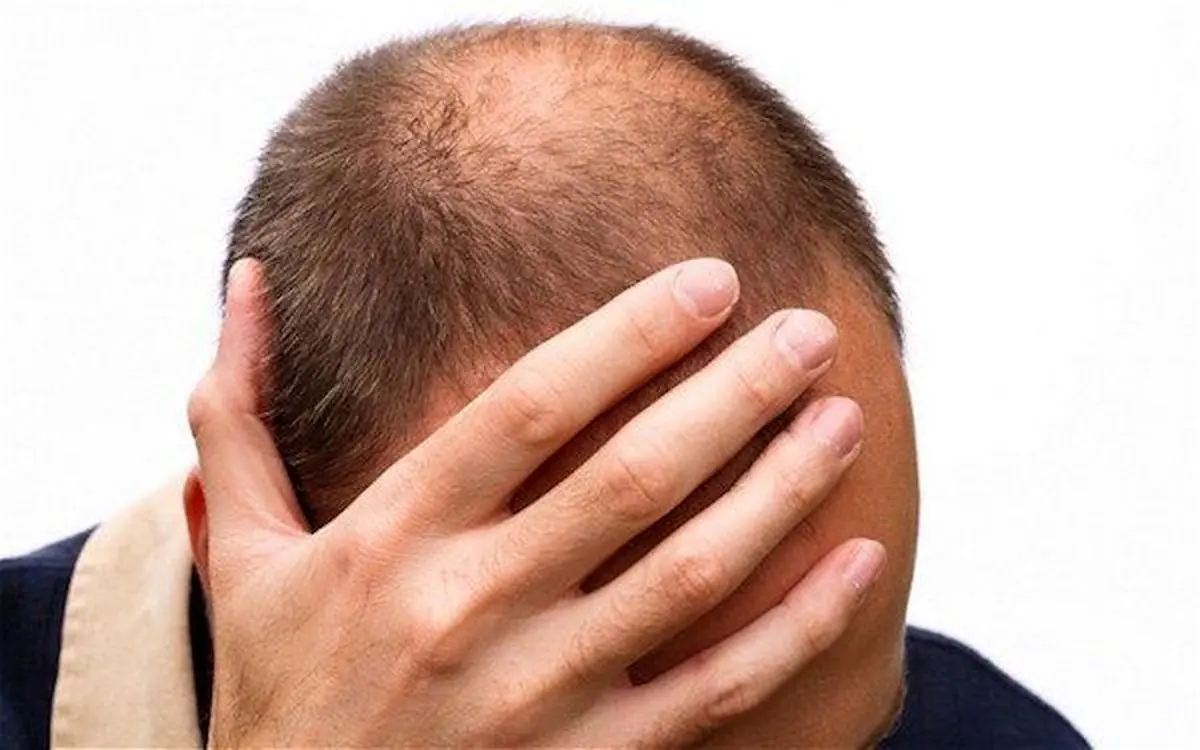 هفت راهکار موثر برای خلاصی از ریزش مو