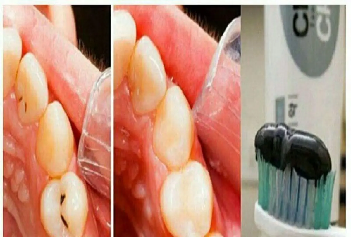 رونمایی از خمیردندان جادویی ژاپنی ها