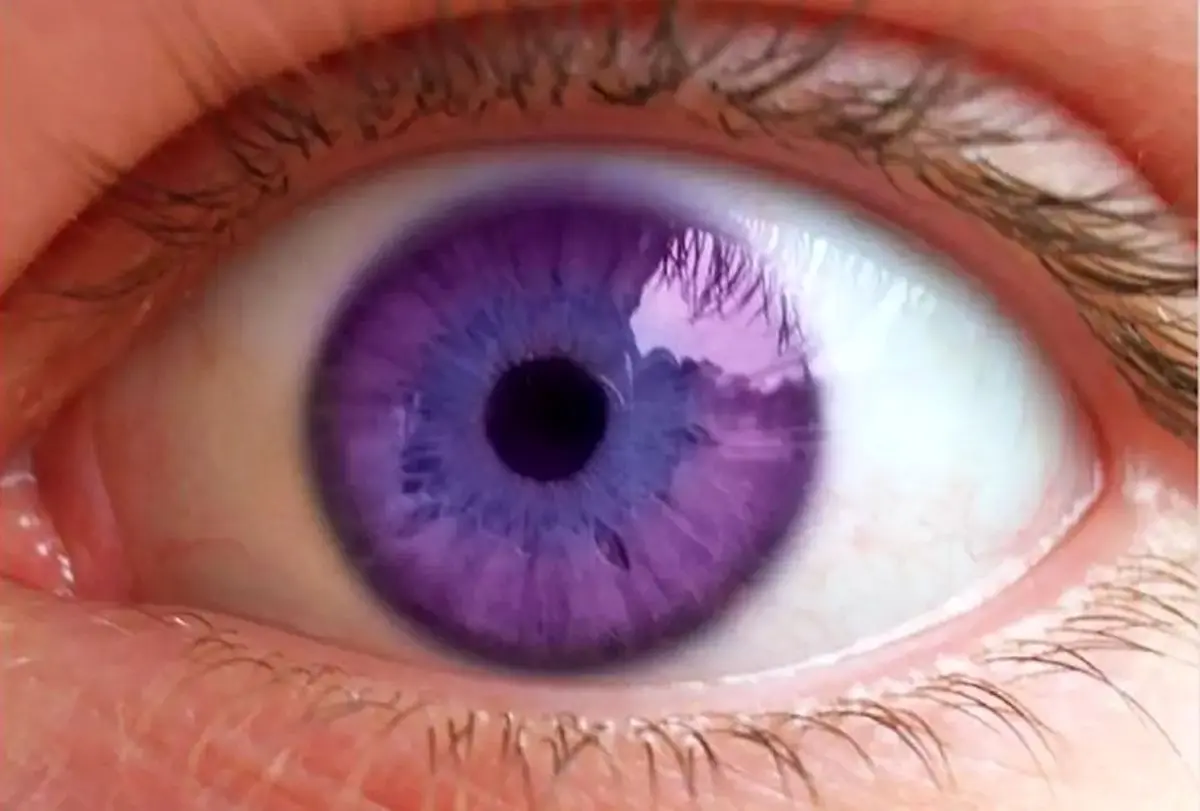 عجیب‌ترین رنگ چشم جهان؛ بنفش!