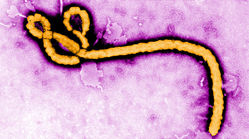 بیماری ابولا دقیقا چه کار می‌کند ؟
