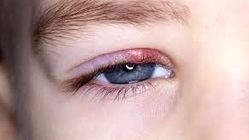 همه چیز درباره گل مژه