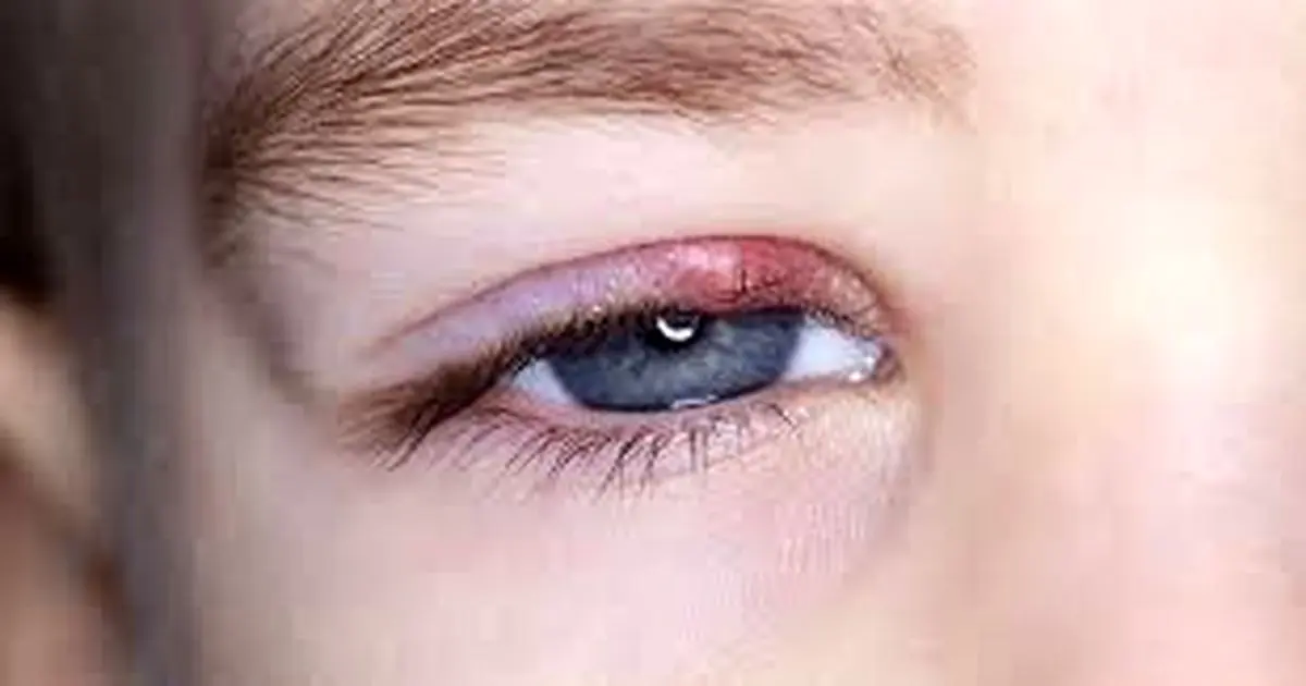 همه چیز درباره گل مژه