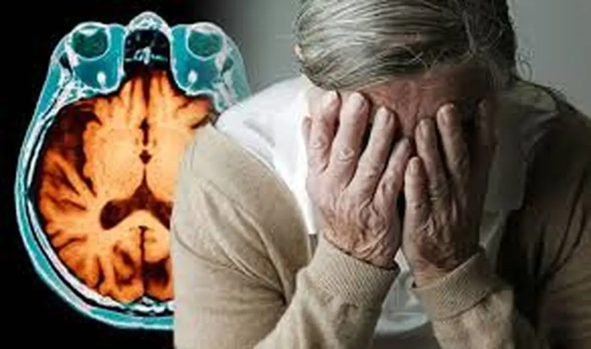 آلزایمر و زوال عقل