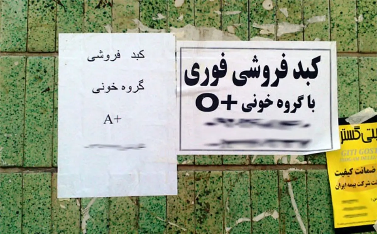 غذاهایی که ترکیب‌شان قاتل کبد است