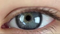 چشمانتان به نور حساسیت دارد؟