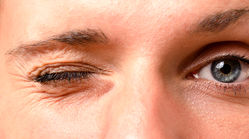 علت پرش پلک چشم چیست؟