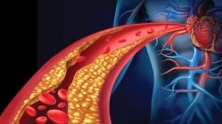 همه چیز درباره فشار خون