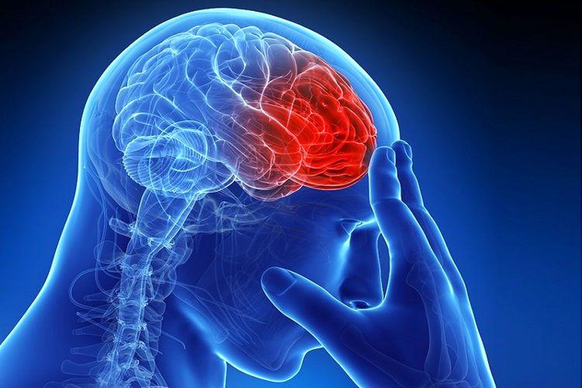 سکته مغزی دومین عامل مرگ ایرانیها
