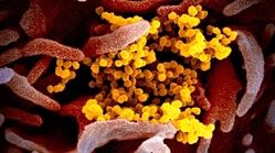 انتشار اولین تصاویر واقعی از قیافه ویروس کرونا