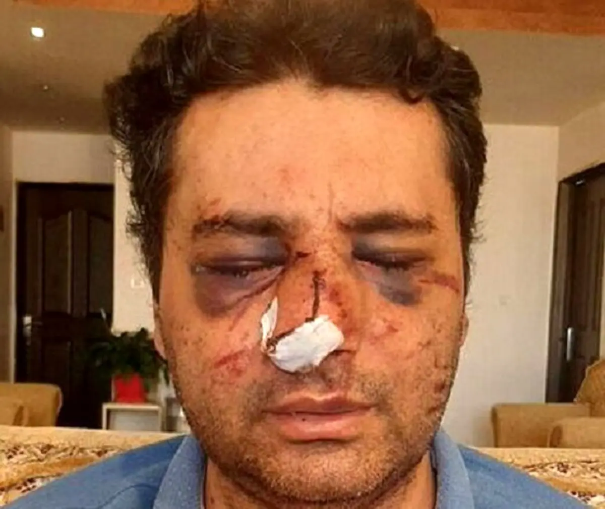 ضرب و شتم شدید یک متخصص بیهوشی در پیرانشهر