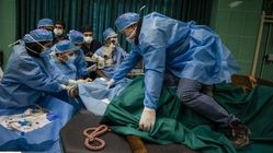 عکس | نخستین جراحی آب‌مروارید چشم اسب در ایران
