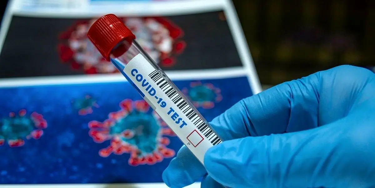 چندساعت بعد از مواجهه با فرد کرونامثبت، تست بدهیم؟