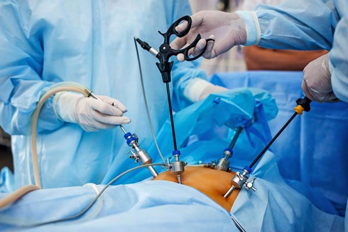 نتیجه یک پژوهش در تاثیر جراحیلاغری روی کیفیتزندگی