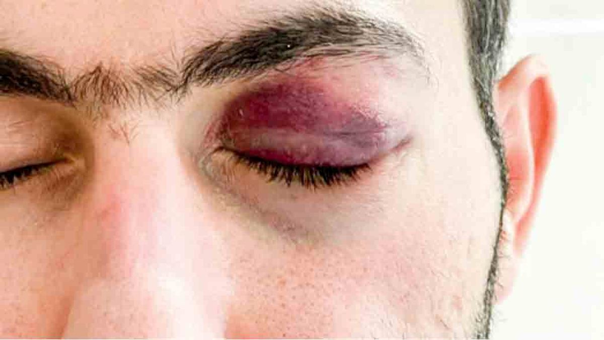 حمله جوان داغدار به دکتر بندرعباسی
