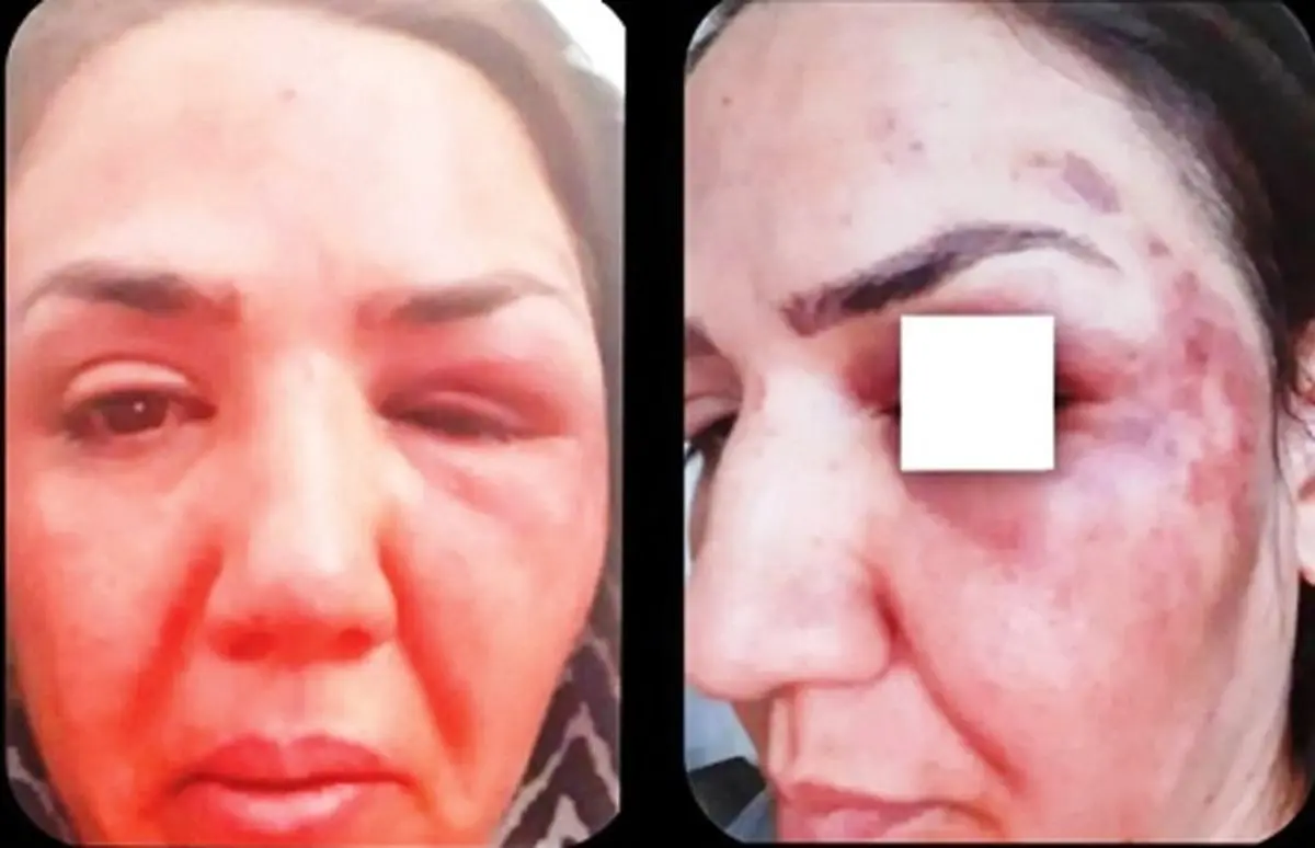 جزئیات حمله ‌وحشیانه ‌به ‌خانم دکتر آبادانی