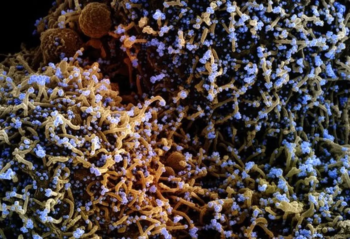 کشف سرنخ‌ جدید درباره فعالیت ویروس در ریه بیماران کووید۱۹