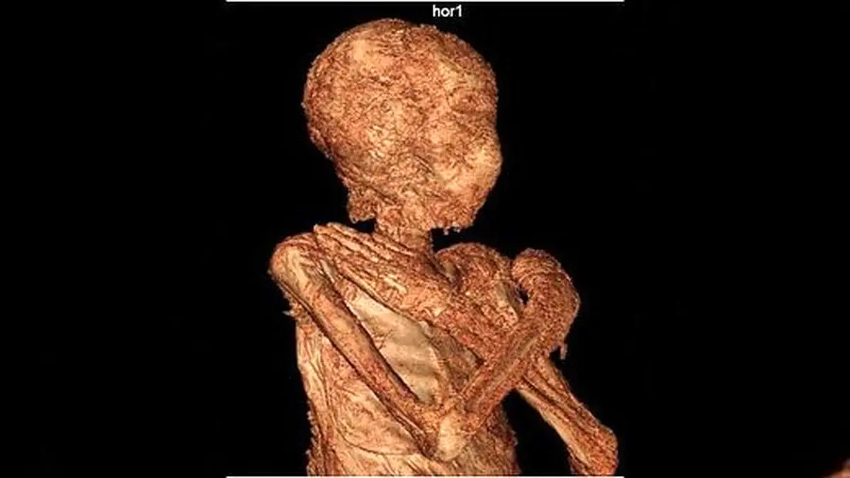 حفظ جنین در بدن زن مومیایی دو هزار ساله