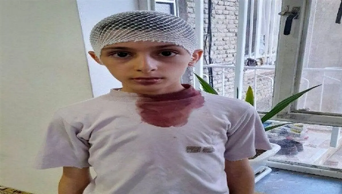 شکستن سر دانش‌آموز با تخته‌پاک‌کن توسط معلم در اشنویه