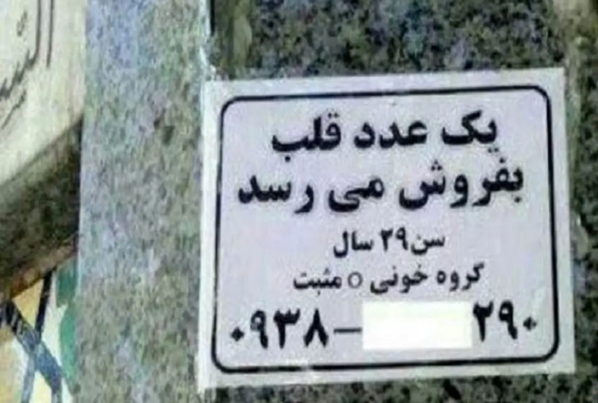 ببینید | پشت پرده فیلم جنجالی اهدای اعضای بدن از یک فرد زنده