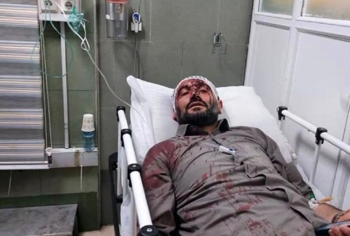 شهردار ناحیه ۳ منطقه ۱۹ به‌اتهام خودزنی برکنار شد