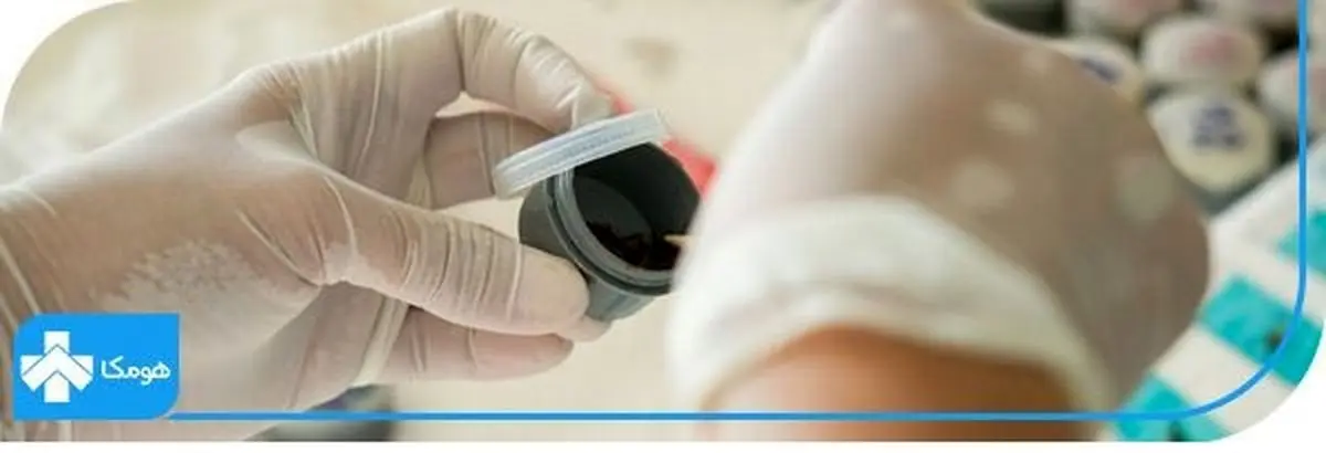 دردهای شکمی و نیاز به آزمایش کشت مدفوع