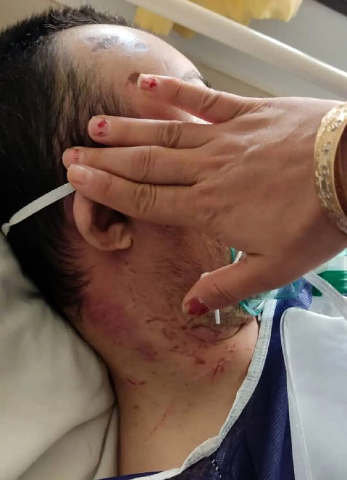 ضرب و شتم بیمار سندروم داون در سمنان تایید شد