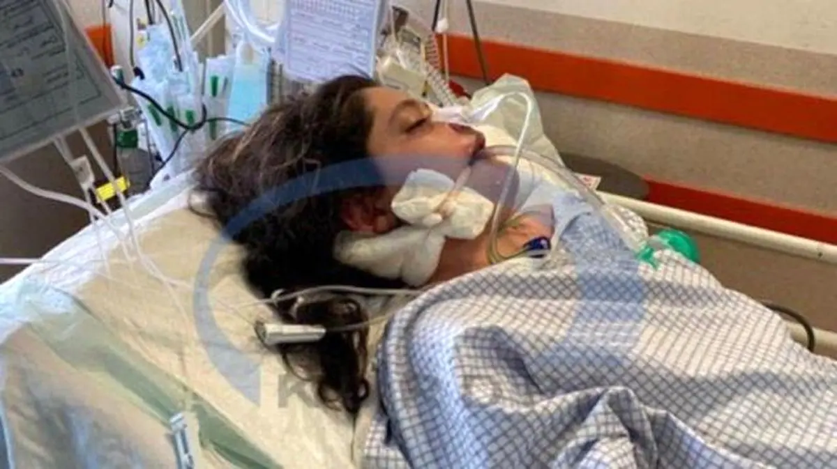 یک اظهار نظر رسمی در مورد سی‌تی‌اسکن «مهسا امینی»