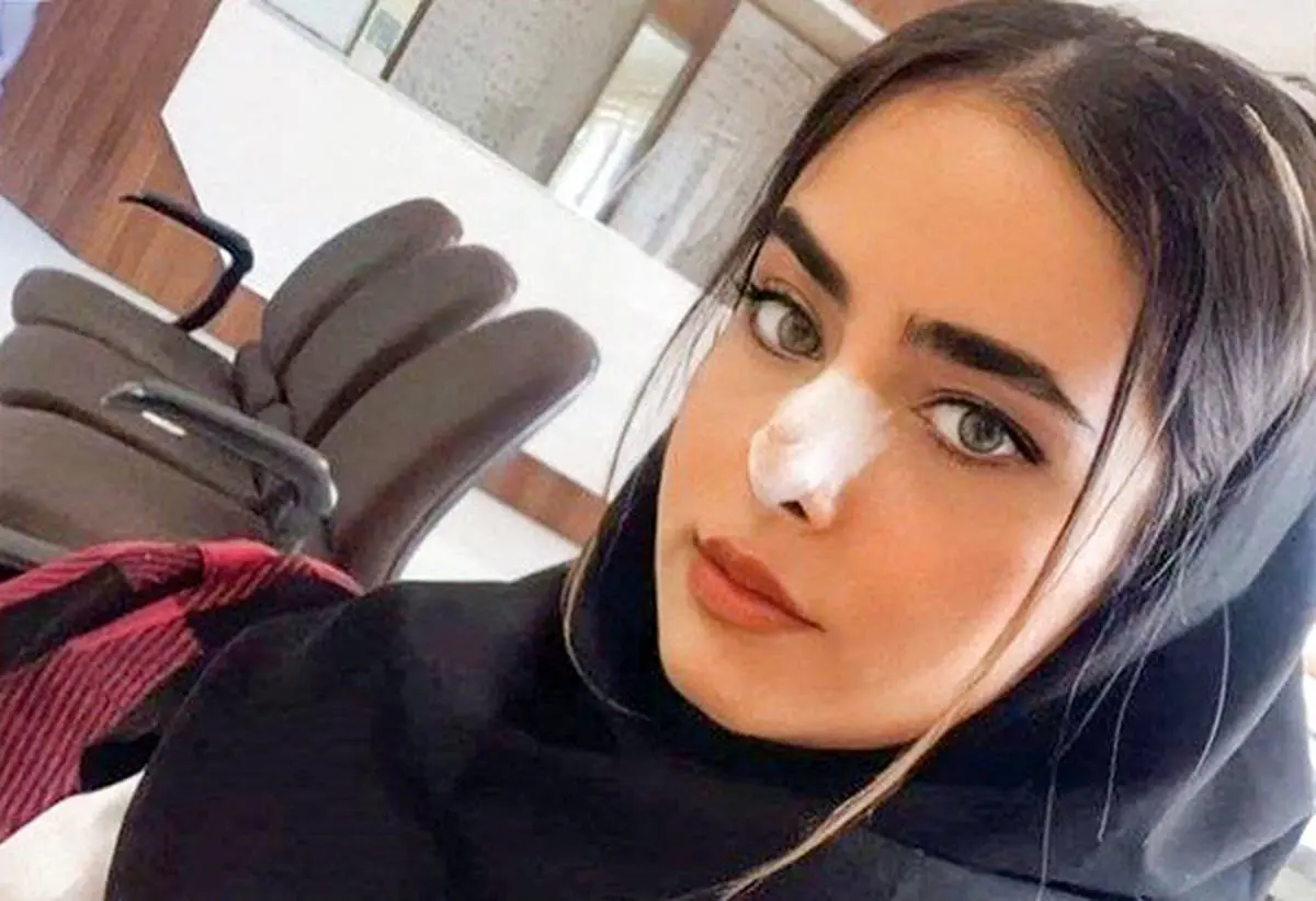 ماجرای مرگ‌ آيلار حقی دانشجوی پزشكی تبريز