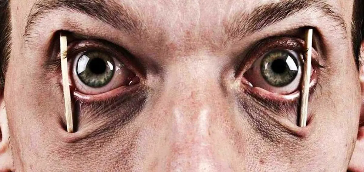 علت پرش اعصاب‌خردکن پلک چشم چیست؟