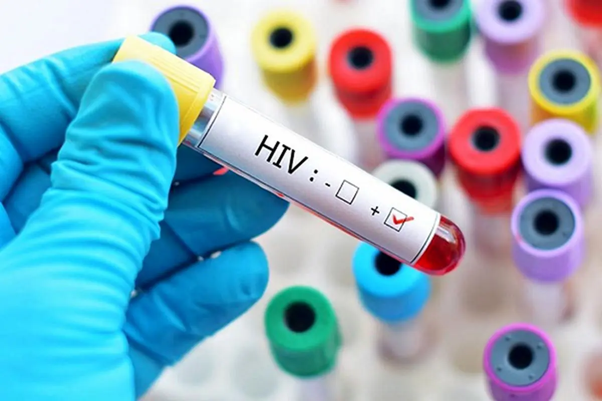 آخرين وضعيت HIV در ايران