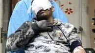چهارشنبه سوری شروع نشده ۵ قربانی گرفت؛ ۱۵ نفر قطع عضو شدند