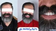 سیر تا پیاز دندان مصنوعی