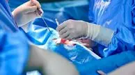 پایان مرگبار آزمایش پیوند کلیه خوک به انسان