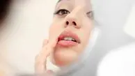 با این خوراکی‌ها‌‌ تبخال را درمان‌ کنید