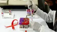 خداحافظی با ایدز؛ موفقیت واکسن آزمایشی «اچ‌آی‌وی» در بدن