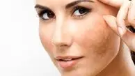 خوراکی هایی که شما را پیر می کنند