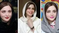 چهره بدون عمل و تزریق بهنوش طباطبایی در 21 سالگی؛ چی بود و چی شد؟!