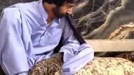 مرد درختی به چه بیماری مبتلاست؛ بهت علم پزشکی مقابل مردی از سیستان و بلوچستان