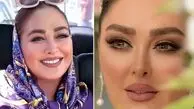مدل مانتو خزدار اعیانی الهام حمیدی ترند بهار 1404