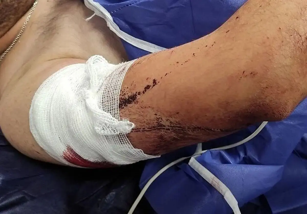 تکرار فاجعه زورگیری از دانشجویان این بار در شهر گرگان
