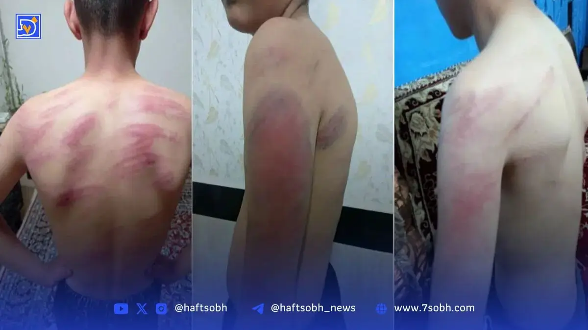 تدریس خشونت| جزئیات حادثه مدرسه شهرری و مورد عجیب کرجو