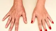 تست نیشگون، روشی ساده برای بررسی سن پوست دست؛ ۵ عادت روزمره که باعث پیری پوست می‌شوند