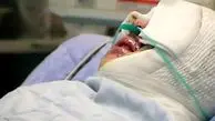 ماجرای هولناک اسیدپاشی روی صورت خانم ناظم در مدرسه