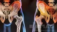 میوه‌ای که شما را از پوکی استخوان نجات می‌دهد