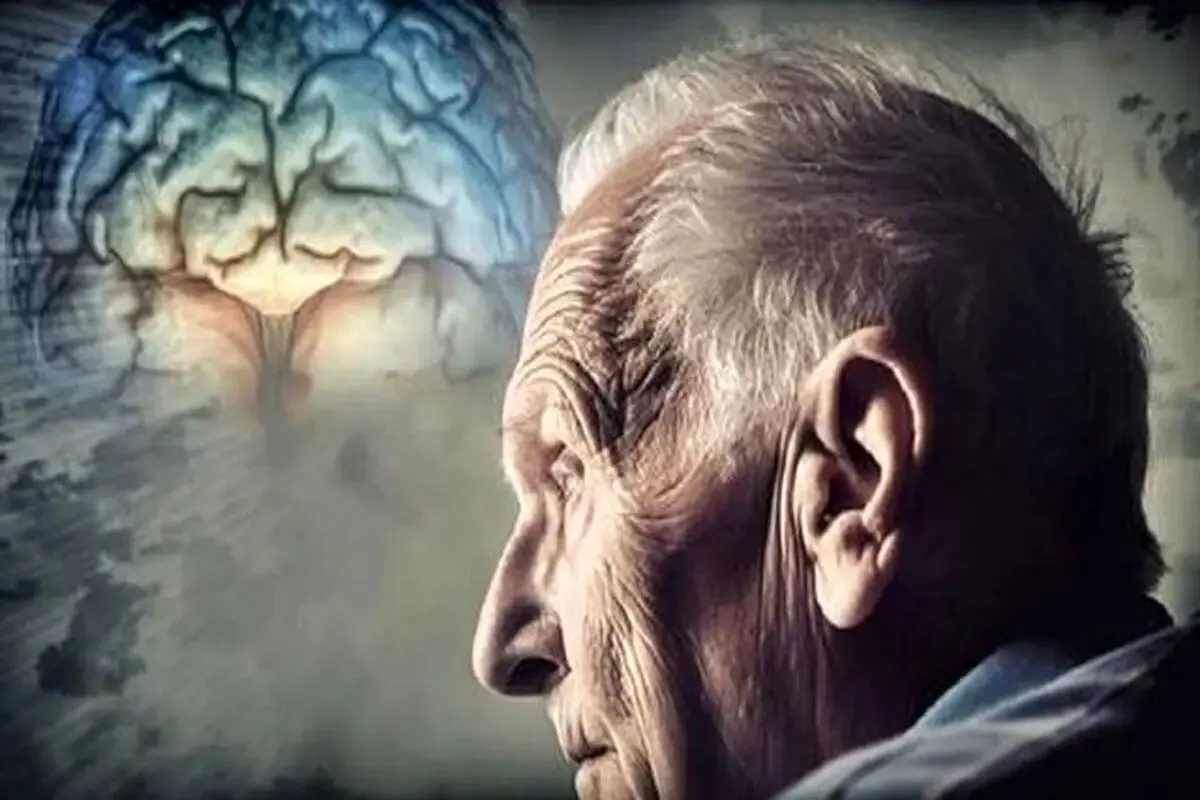 استرالیا اولین داروی درمان بیماری آلزایمر را تایید کرد