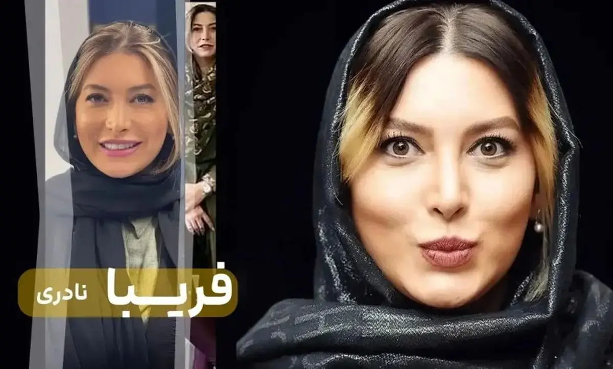 فریبا نادری قبل و بعد از عمل زیبایی