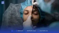 دنیای رنگارنگ تغییر چهره | نقش مافیای تجاری در ترویج عمل‌های زیبایی