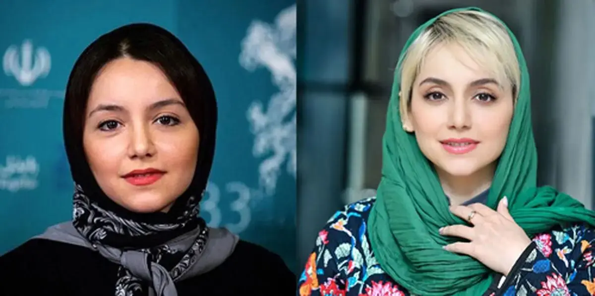 نازنین بیاتی هم جراحی زیبایی کرده؟