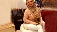 تغییر چهره ‌فاحش صبا کمالی بازیگر  سریال پس از باران ‌در میانسالی