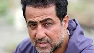 رامین راستاد روی تخت بیمارستان + عکس دردناک